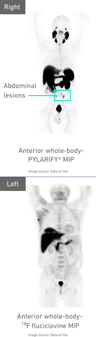 Diagnostic images from the Condor Trial showing abdominal lesions in the human body 